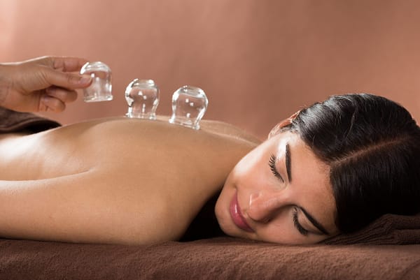 Cupping - Dana Acupuncture & Natural Health
