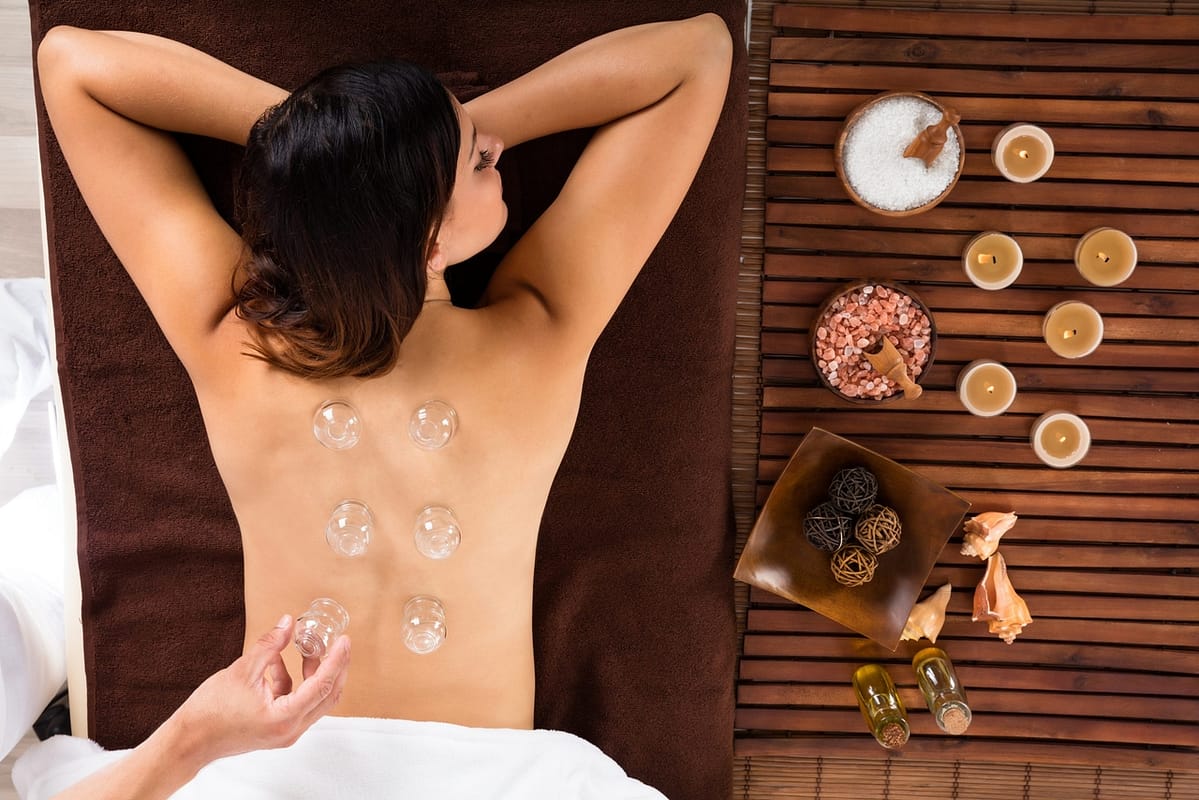 Cupping Treatment On Back - 밴쿠버 한의원